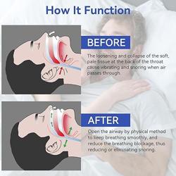 Anti Snoring Devices, Anskysea Snoring Solution - Silicone Magnetic Stop Snoring Aid for Men  Women - Anti Snoring Nose Clip10 Pack