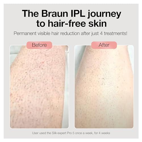 Braun IPL Long-Lasting Hair Removal for Women and Men, Silk Expert Mini  PL1014 with Venus Razor, Long-Lasting Hair Reducation in Hair Regrowth for