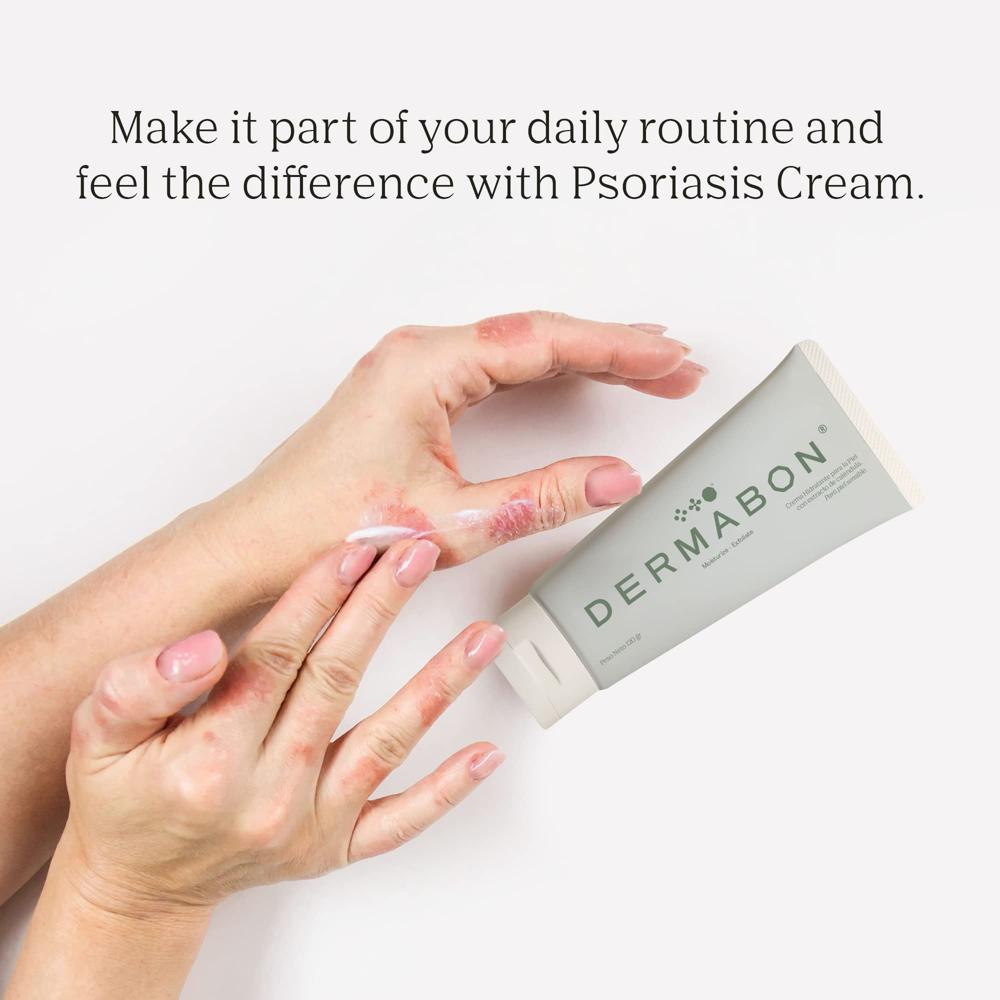 DERMABON Seborrheic Dermatitis Cream 3 Pack Psoriasis Soap Bar Bundle