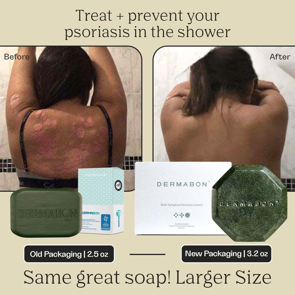 DERMABON Seborrheic Dermatitis Cream 3 Pack Psoriasis Soap Bar Bundle
