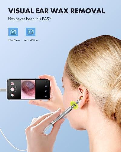 Anykit Digital Otoscope for iPhone, iPad Android Device, Ultra Clear