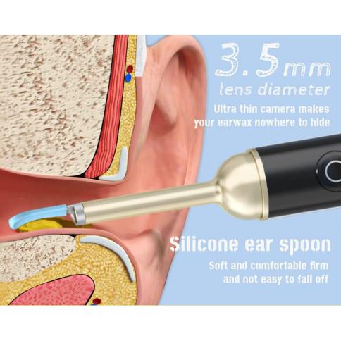Eliminación de cera de 1 pieza, limpiador de oídos con cámara, herramienta  de eliminación de cera de oídos con 1080P, kit de eliminación de cera de oí